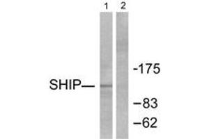 Image no. 1 for anti-Inositol Polyphosphate-5-Phosphatase, 145kDa (INPP5D) (AA 1140-1189) antibody (ABIN1533395)