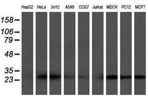 Image no. 10 for anti-Prefoldin Subunit 3 (PFDN3) antibody (ABIN1501704)