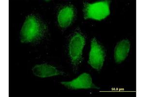 Immunofluorescence of purified MaxPab antibody to BCAP31 on HeLa cell.