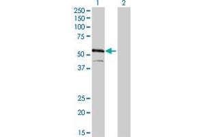 Image no. 1 for anti-Interferon Regulatory Factor 4 (IRF4) (AA 342-451) antibody (ABIN561524)
