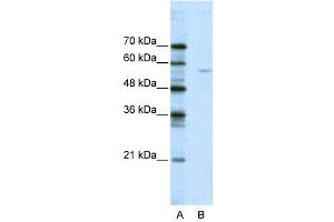 Image no. 2 for anti-ELK1, Member of ETS Oncogene Family (ELK1) (N-Term) antibody (ABIN2780662)