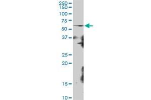 Image no. 2 for anti-Ribosomal RNA Processing 8 (RRP8) (AA 1-456) antibody (ABIN525124)
