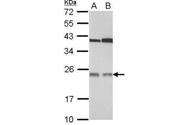 TMED7 antibody  (Center)