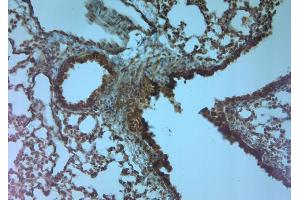 IHC on paraffin sections of rat lung tissue using Rabbit antibody to TRPV4: .