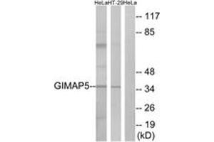 Image no. 1 for anti-GTPase, IMAP Family Member 5 (GIMAP5) (AA 231-280) antibody (ABIN1534960)