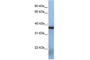 Image no. 1 for anti-N(alpha)-Acetyltransferase 30, NatC Catalytic Subunit (NAA30) (Middle Region) antibody (ABIN631528)