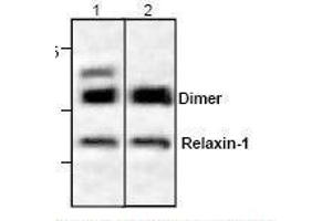 Image no. 1 for anti-Relaxin 1 (RLN1) antibody (ABIN961054)