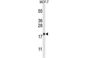 Image no. 1 for anti-Anterior Gradient 3 (AGR3) (AA 126-155), (C-Term) antibody (ABIN950305)