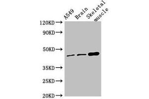 Western Blot Positive WB detected in: A549 whole cell lysate, Mouse brain tissue, Mouse skeletal muscle tissue All lanes: TMEM43 antibody at 4 μg/mL Secondary Goat polyclonal to rabbit IgG at 1/50000 dilution Predicted band size: 45 kDa Observed band size: 45 kDa