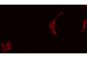 Image no. 1 for anti-Creatine Kinase, Mitochondrial 2 (Sarcomeric) (CKMT2) antibody (ABIN6257061)