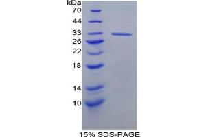 Image no. 1 for DNA Topoisomerase II (TOP2) protein (ABIN2967717)