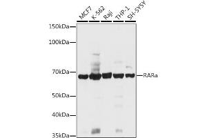 Retinoic Acid Receptor alpha Antikörper  (AA 1-457)