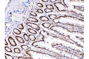 Image no. 2 for anti-High Mobility Group Box 1 (HMGB1) (AA 124-154), (C-Term) antibody (ABIN5518759)