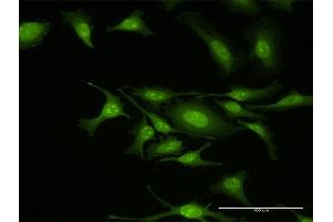 Immunofluorescence of purified MaxPab antibody to GIT2 on HeLa cell.