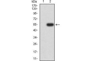 IL21 Receptor antibody  (AA 20-232)