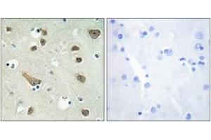 Image no. 2 for anti-14-3-3 gamma (YWHAG1) (AA 51-100) antibody (ABIN1534235)