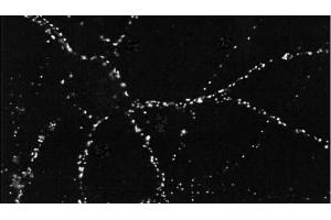 Immunocytochemistry (ICC) image for anti-Discs, Large Homolog 4 (Drosophila) (DLG4) antibody (ABIN361694)