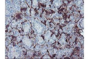 Image no. 1 for anti-alpha-2-HS-Glycoprotein (AHSG) antibody (ABIN1496502)