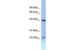 Image no. 1 for anti-Homeobox A2 (HOXA2) (C-Term) antibody (ABIN2779765)