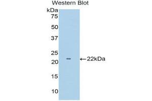 Image no. 1 for anti-Tumor Necrosis Factor Receptor Superfamily, Member 1B (TNFRSF1B) (AA 303-474) antibody (ABIN1174725)