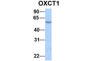 Image no. 2 for anti-3-Oxoacid CoA Transferase 1 (OXCT1) (N-Term) antibody (ABIN2783387)