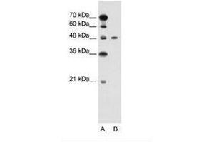 Image no. 1 for anti-Pre-B-Cell Leukemia Homeobox Protein 1 (PBX1) (N-Term) antibody (ABIN6736594)