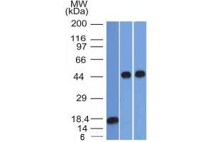 Image no. 1 for anti-serpin Peptidase Inhibitor, Clade A (Alpha-1 Antiproteinase, Antitrypsin), Member 1 (SERPINA1) antibody (ABIN6940312)