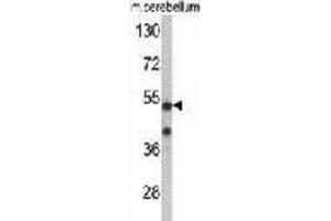 Image no. 3 for anti-Cyclin-Dependent Kinase 14 (CDK14) antibody (ABIN3002794)
