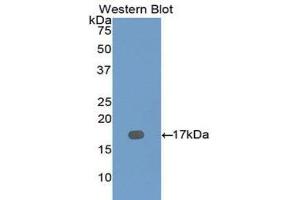 Dymeclin antibody  (AA 546-669)