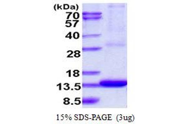 ARL9 Protein (AA 1-123) (His tag)