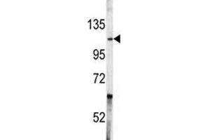 Image no. 2 for anti-C-Abl Oncogene 1, Non-Receptor tyrosine Kinase (ABL1) (AA 741-769) antibody (ABIN3028519)