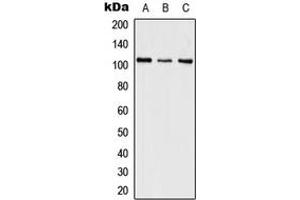 Image no. 1 for anti-Splicing Factor, Suppressor of White-Apricot Homolog (SFSWAP) (Center) antibody (ABIN2707124)
