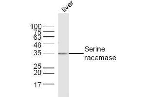 Image no. 3 for anti-Serine Racemase (SRR) (AA 1-100) antibody (ABIN2690282)