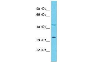 Image no. 1 for anti-Hydroxyacylglutathione Hydrolase-Like (HAGHL) (C-Term) antibody (ABIN2791038)