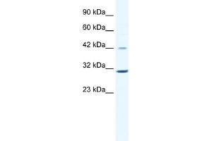 Image no. 1 for anti-Cyclin D3 (CCND3) (C-Term) antibody (ABIN2792167)