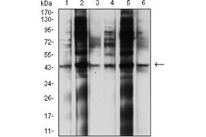Image no. 5 for anti-Lysosomal-Associated Membrane Protein 2 (LAMP2) (AA 29-168) antibody (ABIN5611243)