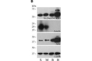 Image no. 6 for anti-Actin, Alpha, Cardiac Muscle 1 (ACTC1) (Center) antibody (ABIN2855212)