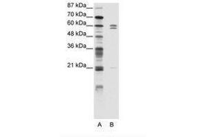 Image no. 1 for anti-FEZ Family Zinc Finger 2 (FEZF2) (C-Term) antibody (ABIN203150)