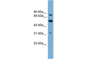 Image no. 1 for anti-Tousled-Like Kinase 2 (TLK2) (N-Term) antibody (ABIN2774221)