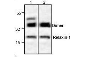 Image no. 1 for anti-Relaxin 1 (RLN1) antibody (ABIN411577)