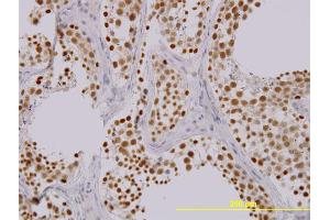 Image no. 2 for anti-TAO Kinase 1 (TAOK1) (AA 892-1001) antibody (ABIN528225)