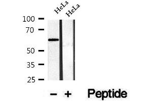 Image no. 2 for anti-CTD (Carboxy-Terminal Domain, RNA Polymerase II, Polypeptide A) Small Phosphatase Like 2 (CTDSPL2) (pSer104) antibody (ABIN6256089)