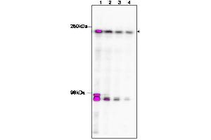 Image no. 2 for anti-TAF1 RNA Polymerase II, TATA Box Binding Protein (TBP)-Associated Factor, 250kDa (TAF1) (C-Term) antibody (ABIN233826)