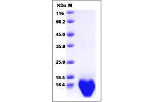 Image no. 1 for Chemokine (C-C Motif) Ligand 3 (CCL3) (AA 24-92) protein (ABIN2008639)