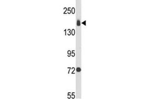 Image no. 1 for anti-Integrin alpha 2 (ITGA2) (AA 1023-1049) antibody (ABIN3031363)