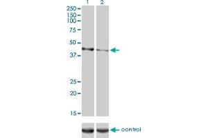 Western blot analysis of CALR3 over-expressed 293 cell line, cotransfected with CALR3 Validated Chimera RNAi (Lane 2) or non-transfected control (Lane 1).