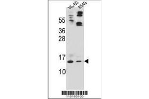 Image no. 2 for anti-Apolipoprotein C-II (APOC2) (AA 45-73) antibody (ABIN392226)