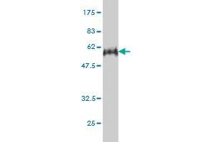 Image no. 3 for anti-E2F Transcription Factor 6 (E2F6) (AA 1-281) antibody (ABIN560683)