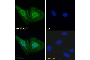 Image no. 2 for anti-Notch 1 (NOTCH1) (AA 171-182) antibody (ABIN6391411)