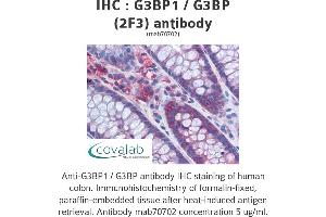 Image no. 2 for anti-GTPase Activating Protein (SH3 Domain) Binding Protein 1 (G3BP1) (AA 214-303) antibody (ABIN1723559)